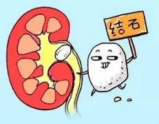 小石頭大麻煩，難道只能一碎了之？中醫(yī)專家李琦告訴你腎結(jié)石得這
