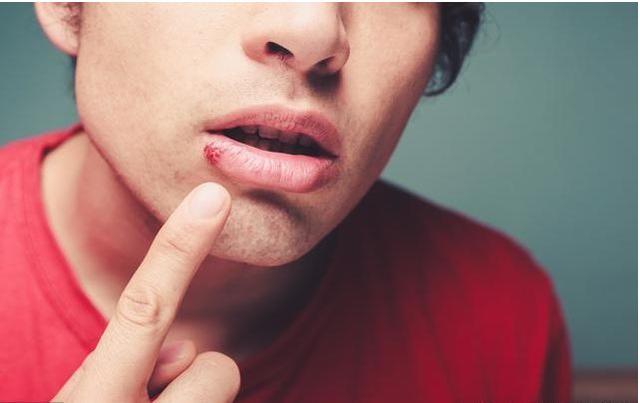 你容易“上火”嗎？